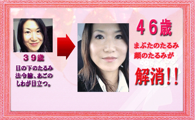 �ǂ���̎ʐ^���Ⴍ�����܂����H